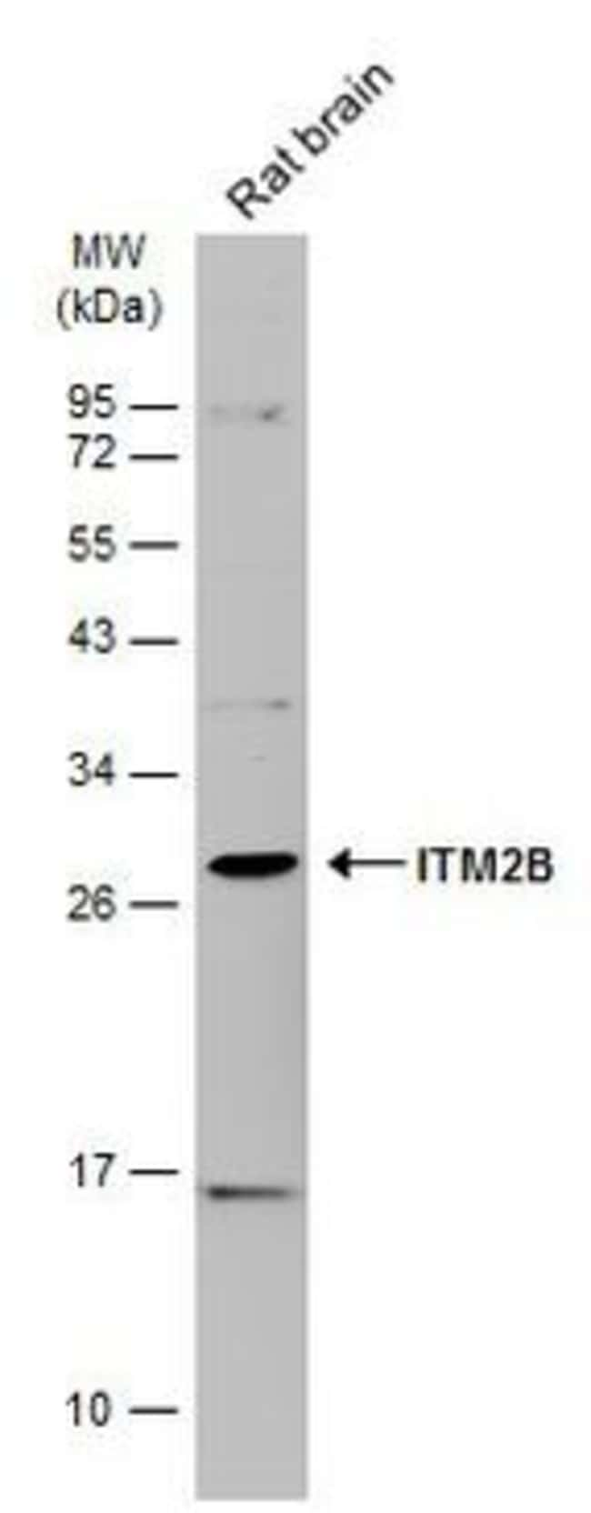 ANTI-ITM2B