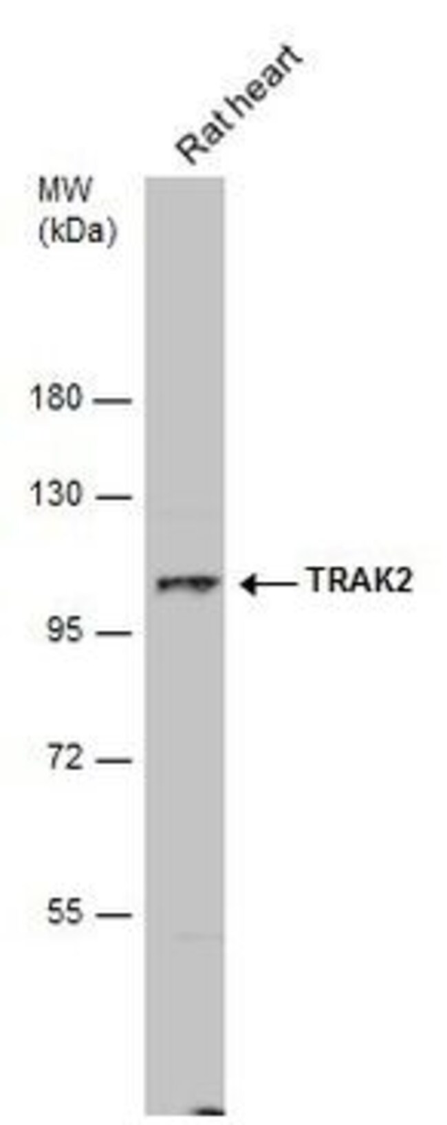 ANTI-TRAK2