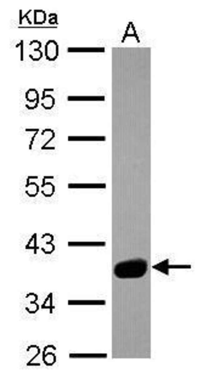 ANTI-SPSB3