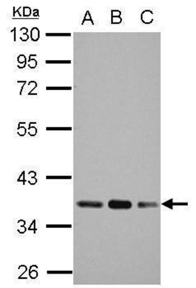 ANTI-PYRUVATE DEHYDROGENASE E1 BETA SUBU