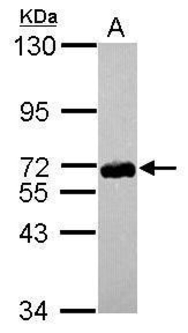 ANTI-ZNF587