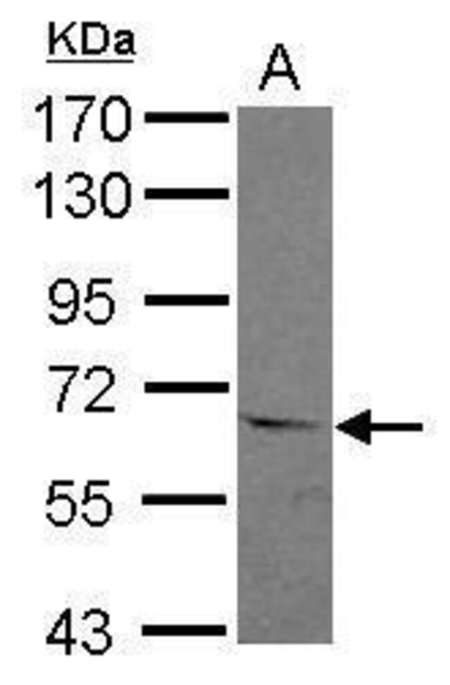 ANTI-ASC1