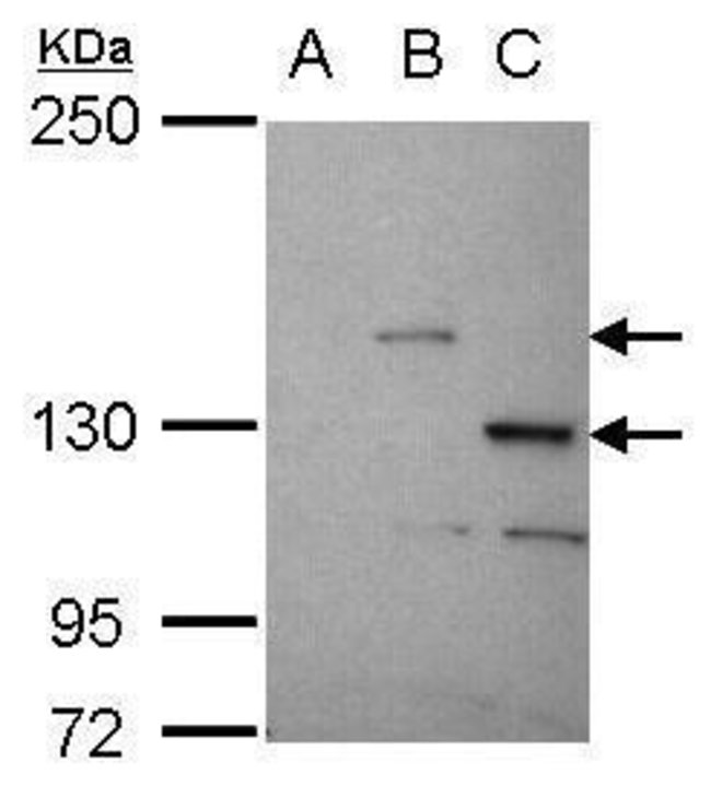 ANTI-STK31