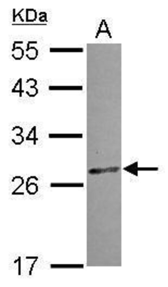 ANTI-CCDC28B