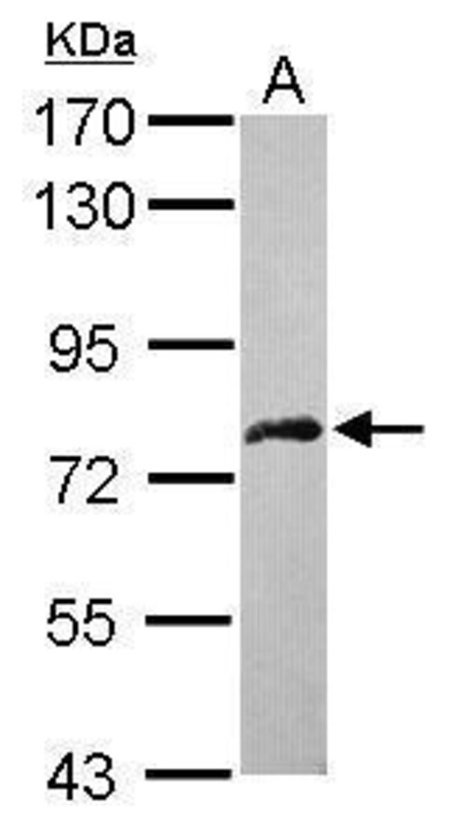 ANTI-DDX59