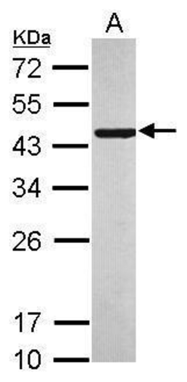 ANTI-C10ORF93