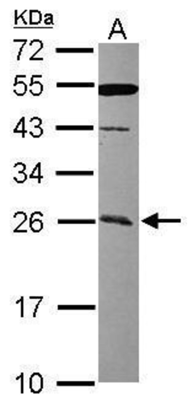 ANTI-CCDC90B