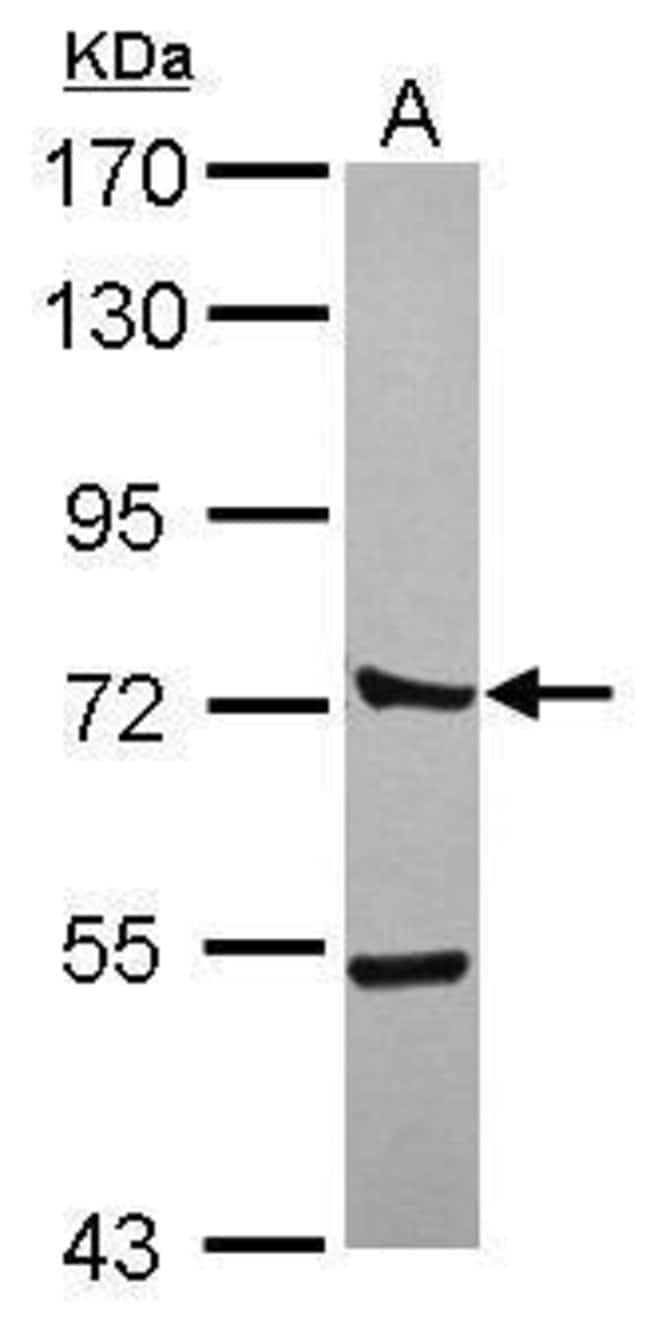 ANTI-CTTNBP2NL