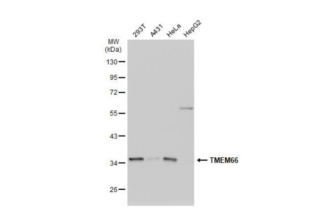 ANTI-TRANSMEMBRANE PROTEIN 66