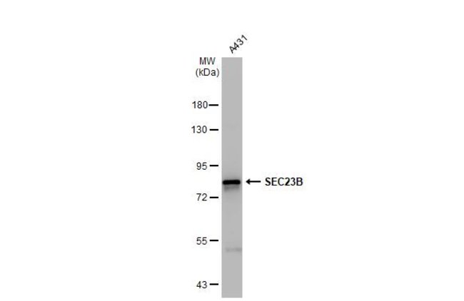 ANTI-SEC23B