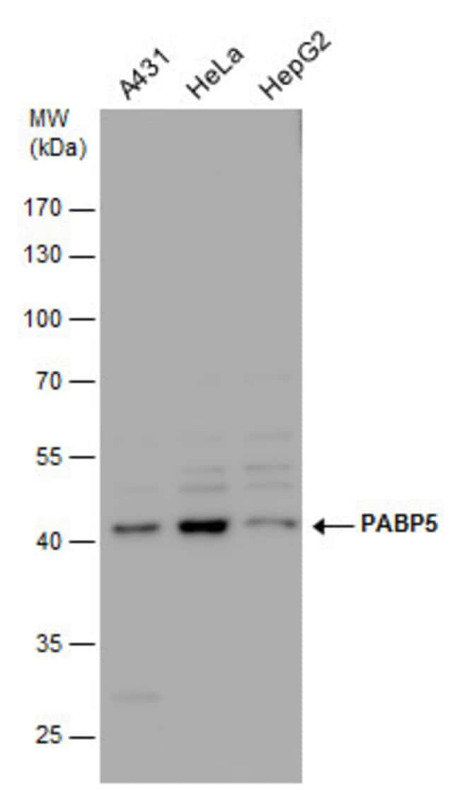 ANTI-PABP5