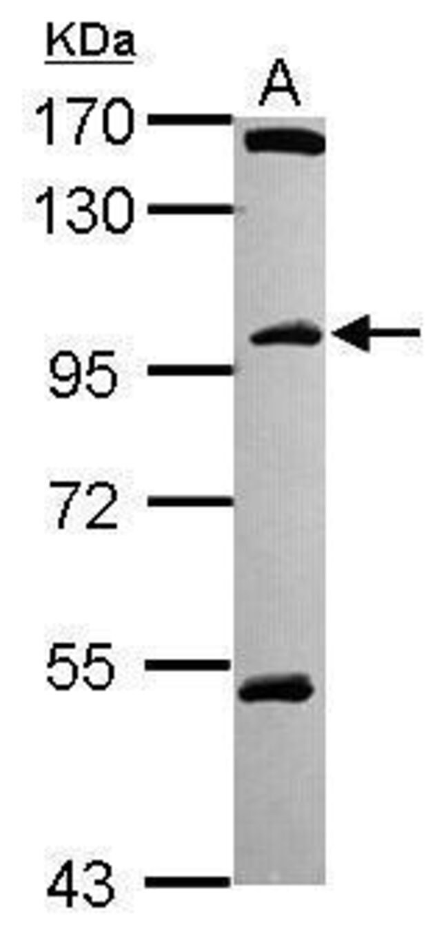 ANTI-C18ORF34