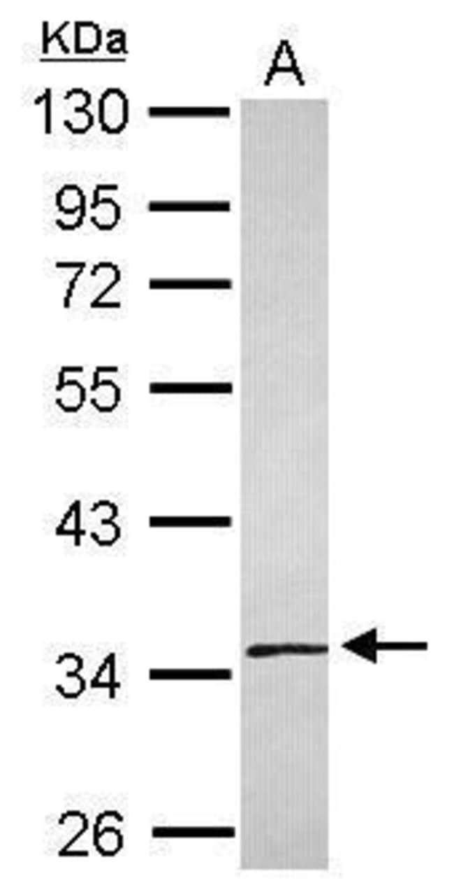 ANTI-SLC25A36