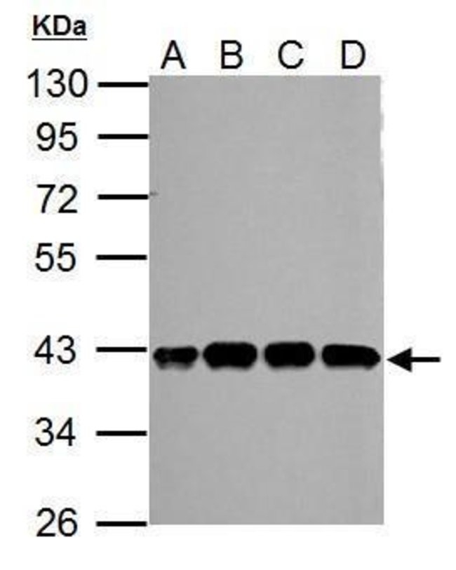 ANTI-SLFNL1