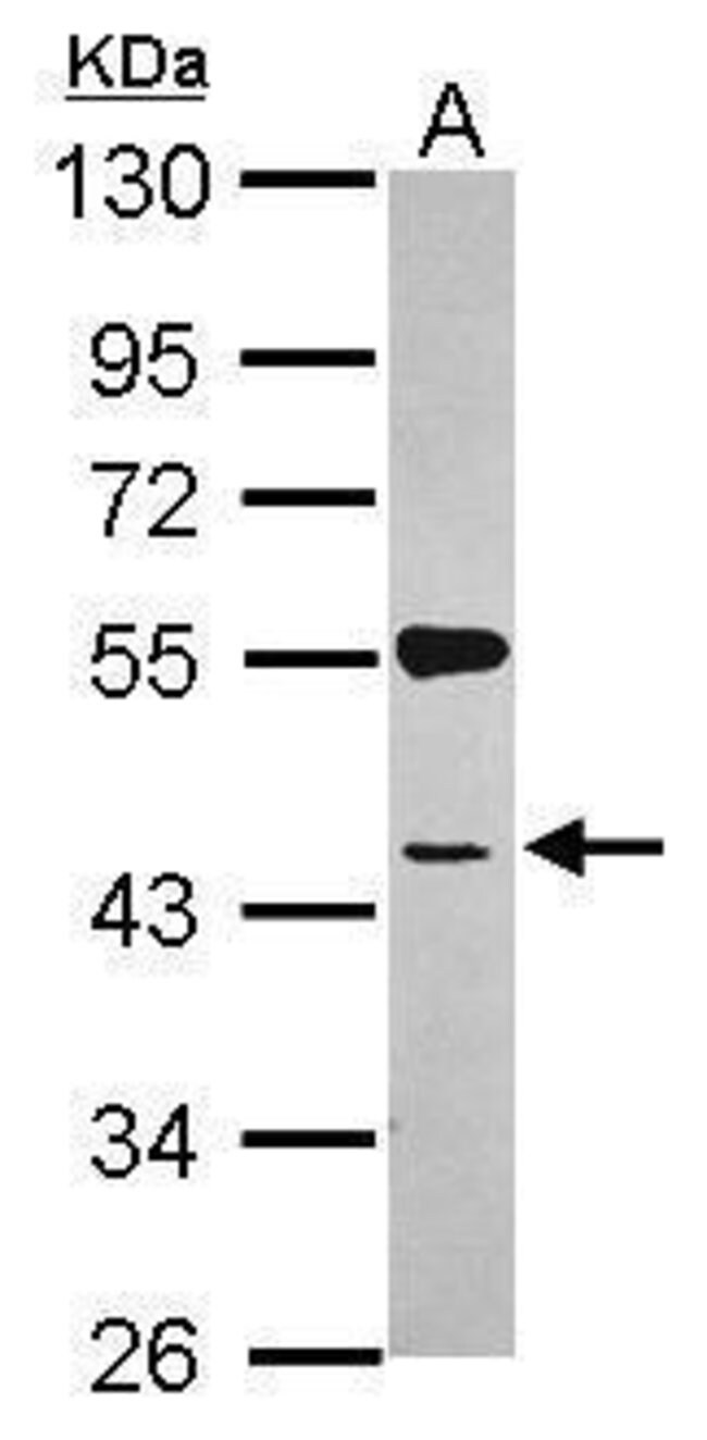 ANTI-SYAP1