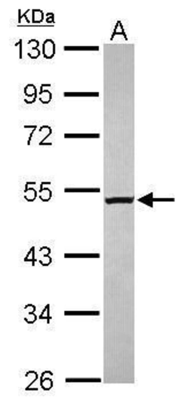 ANTI-C2ORF65