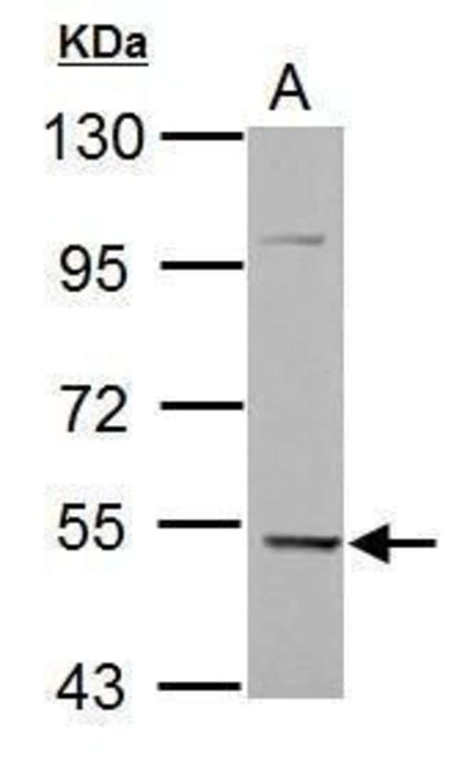 ANTI-KLHDC5