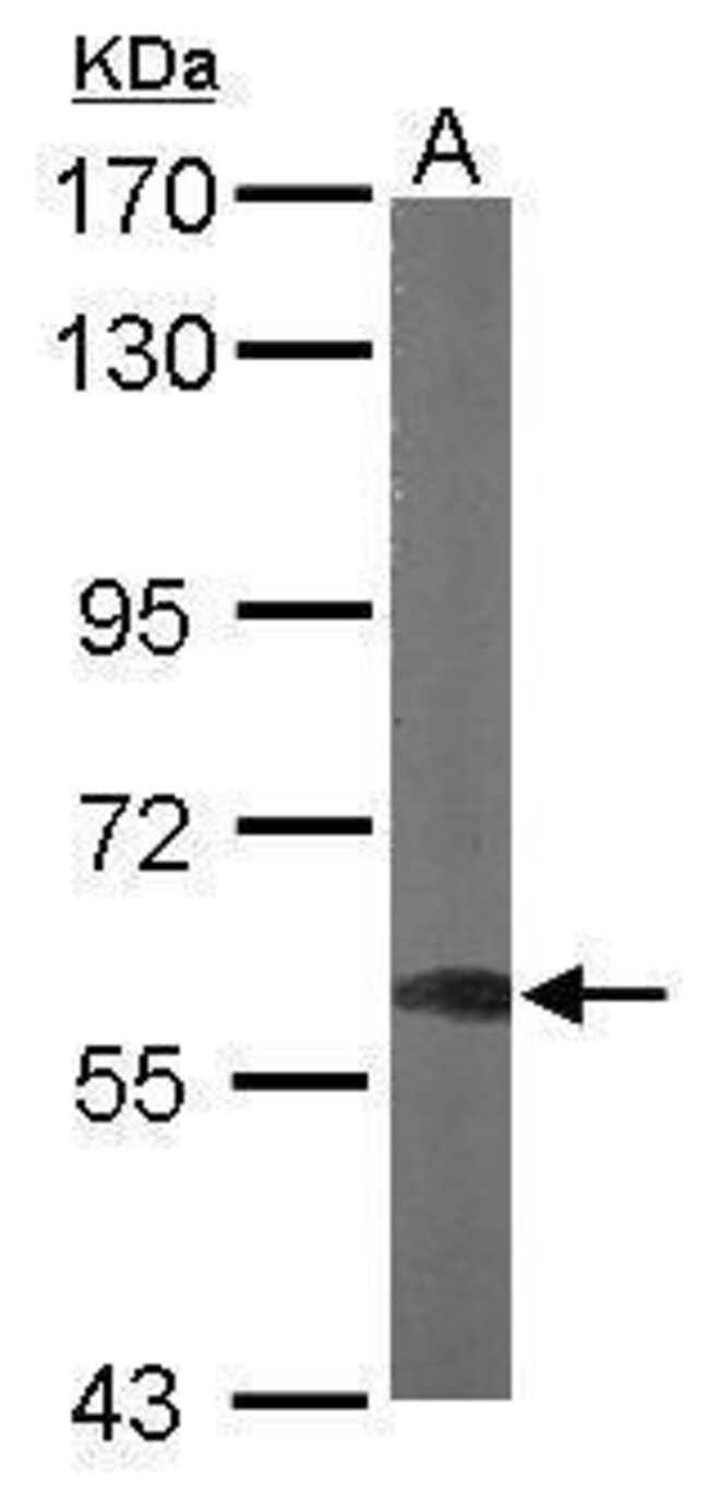 ANTI-DYNC1LI1