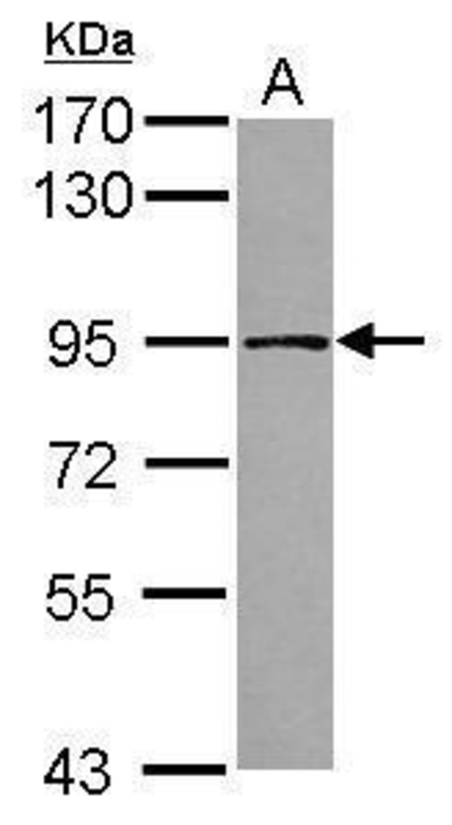 ANTI-TARS2