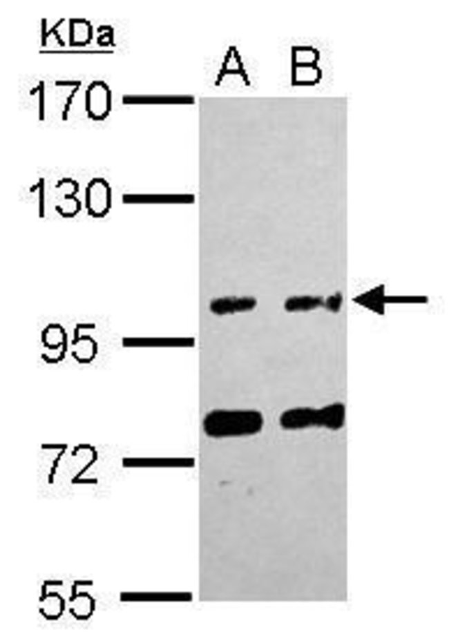 ANTI-FAM171A1