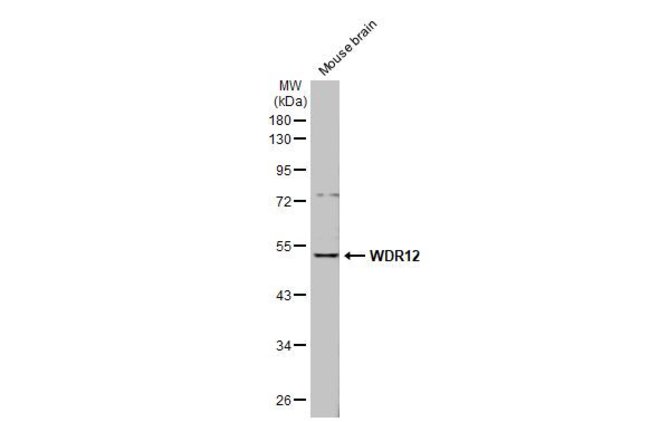 ANTI-WDR12