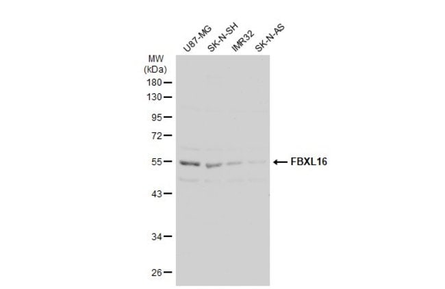 ANTI-FBXL16