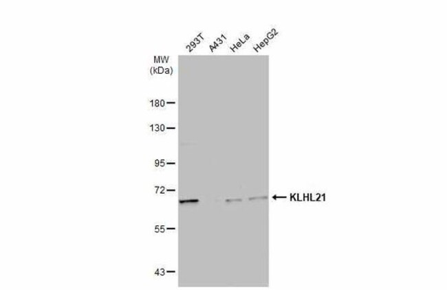 ANTI-KLHL21