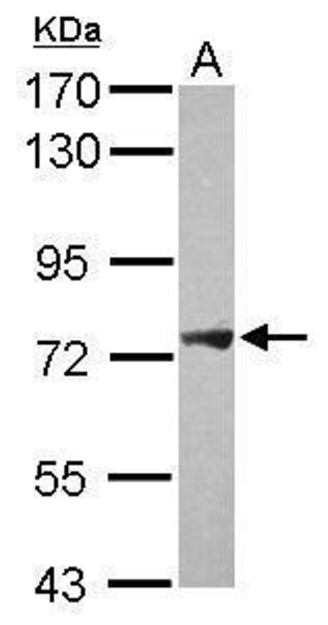 ANTI-PLA2G4F