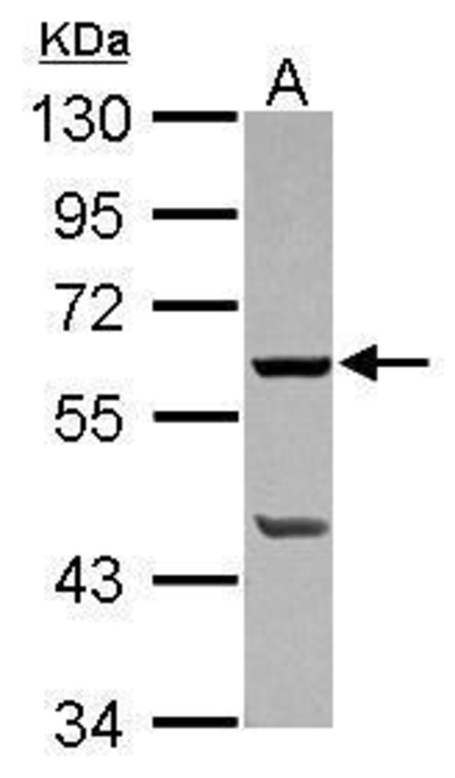 ANTI-PLA2G4F