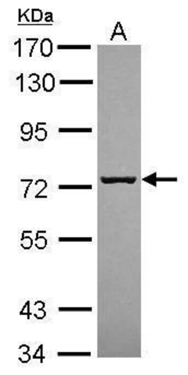 ANTI-SCFD1