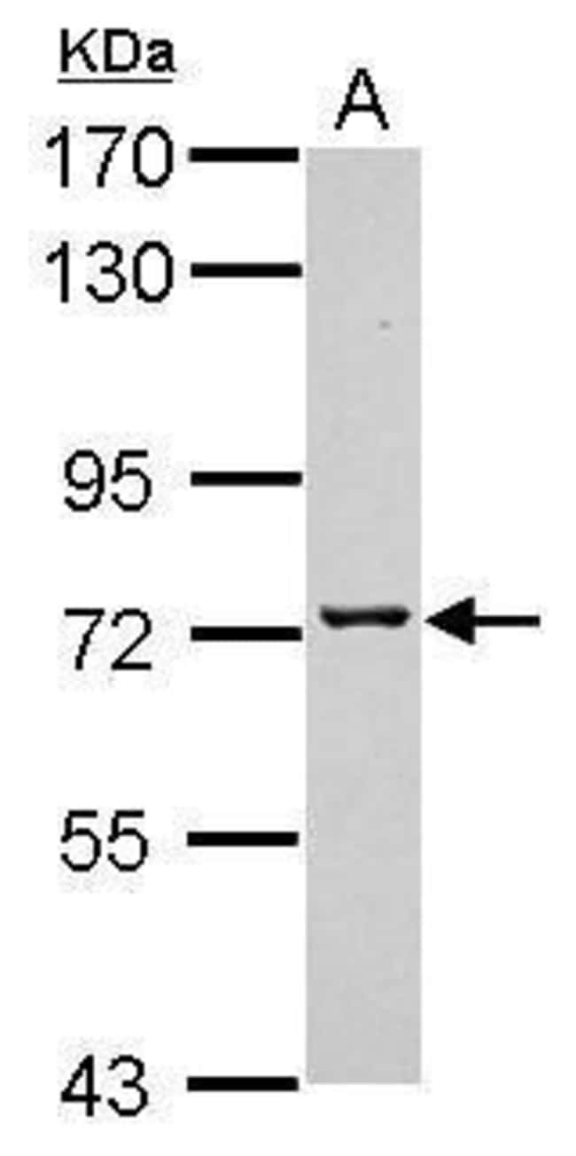 ANTI-TMCO3