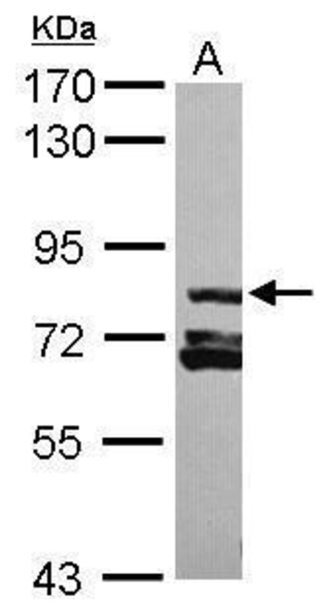 ANTI-RAB11FIP3