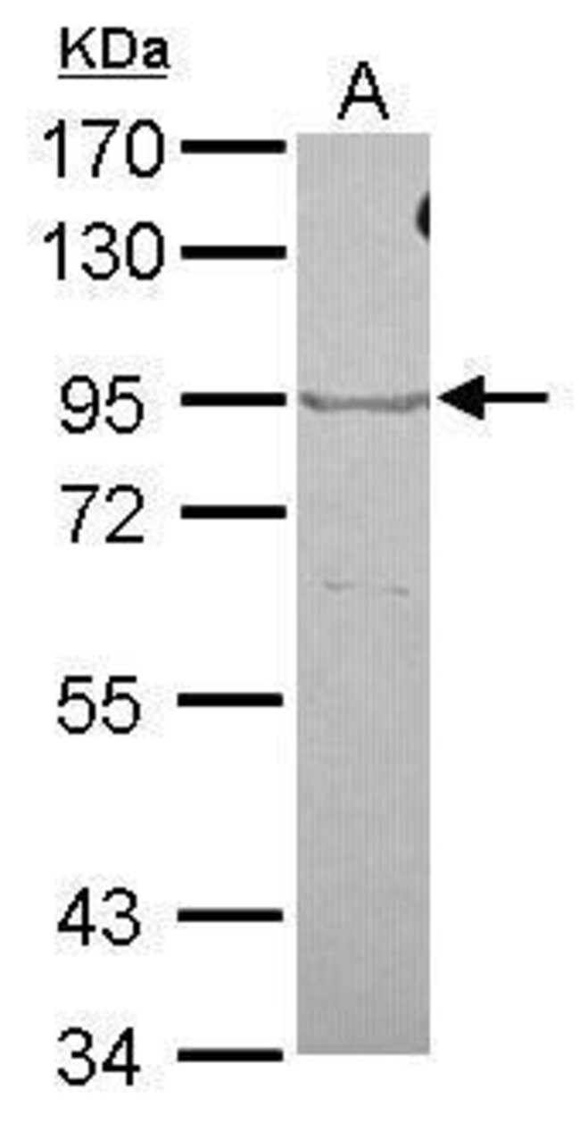 ANTI-OXR1