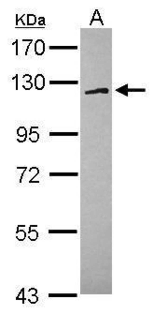 ANTI-FAM120A