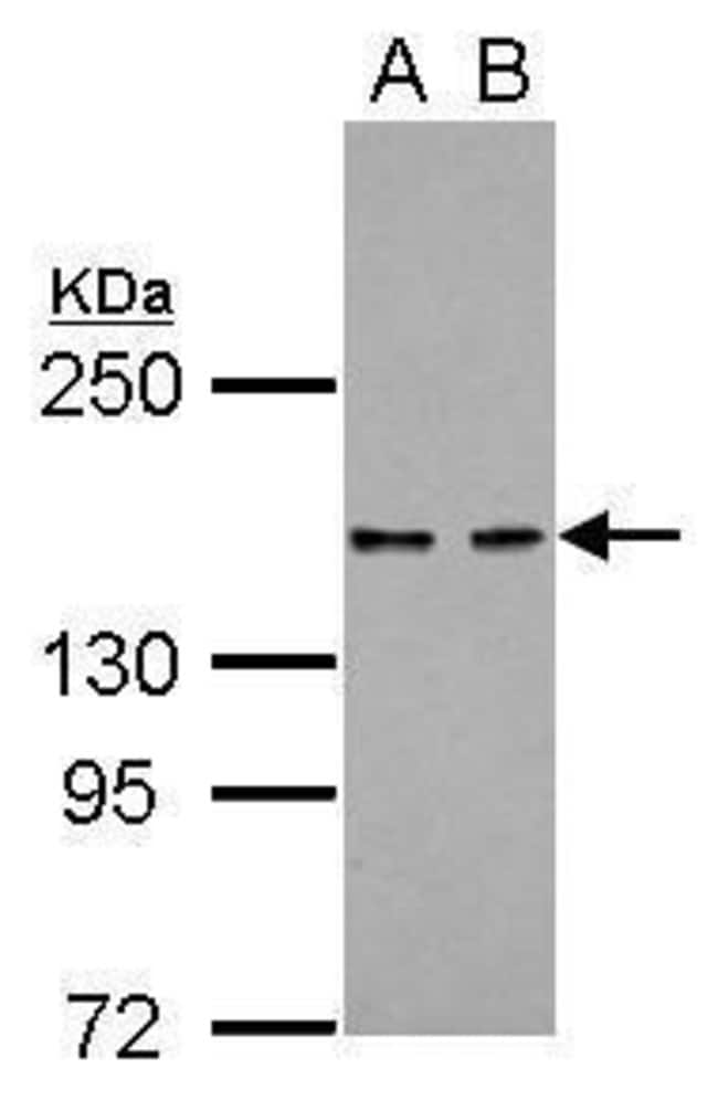 ANTI-KDM6A