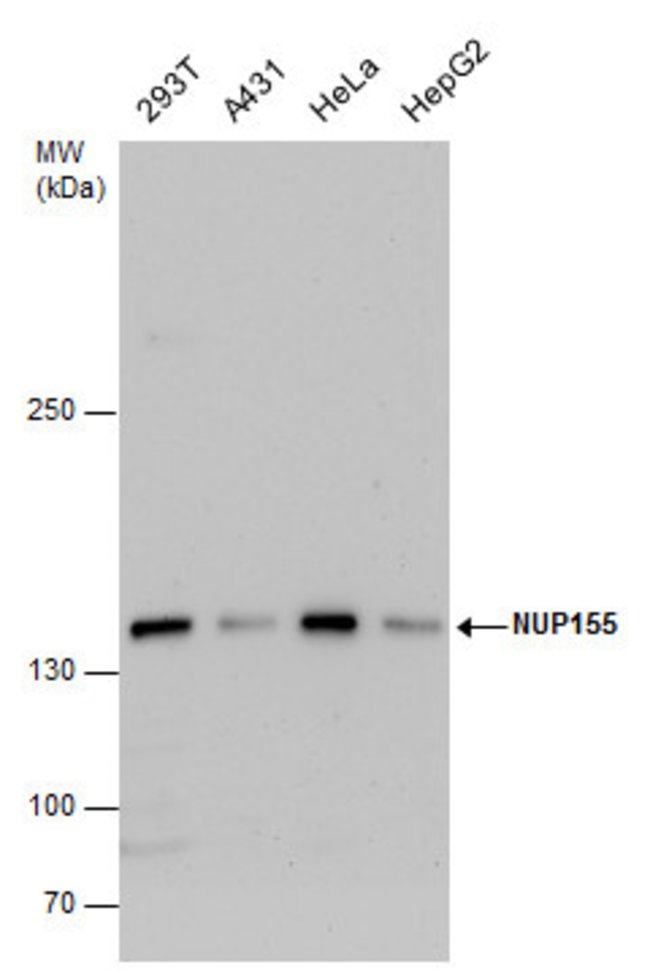 ANTI-NUP155