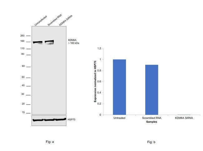 100uL Polyclonal antibody, KDM6A, host r