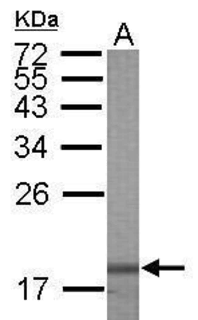 ANTI-GALECTIN 7