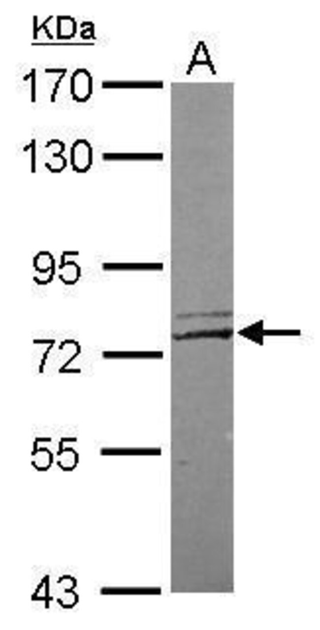 ANTI-NETRIN G1 LIGAND