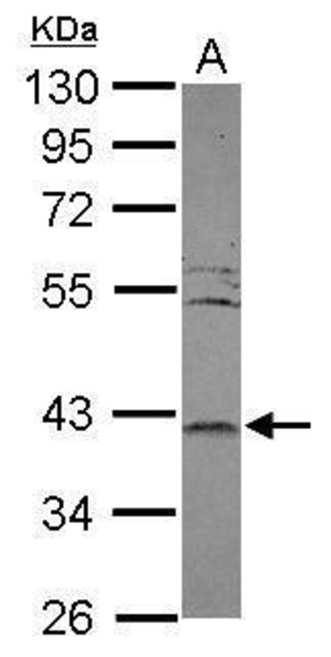 ANTI-LRRC23