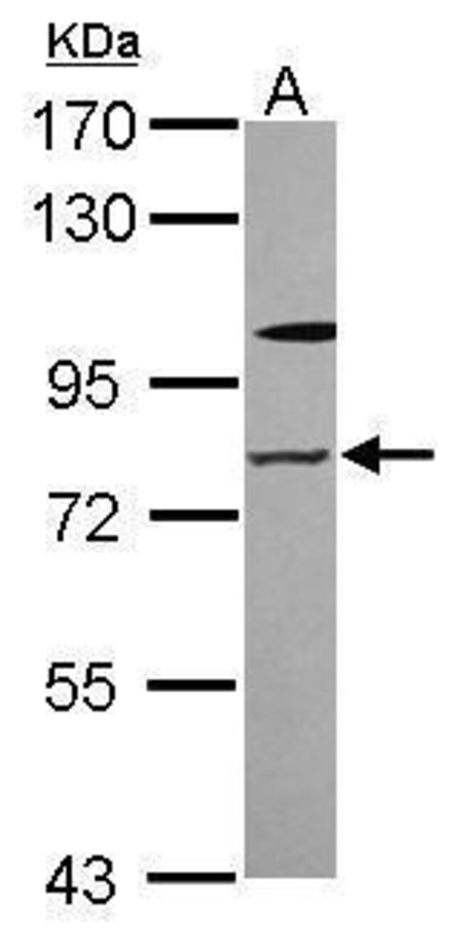 ANTI-ZNF287