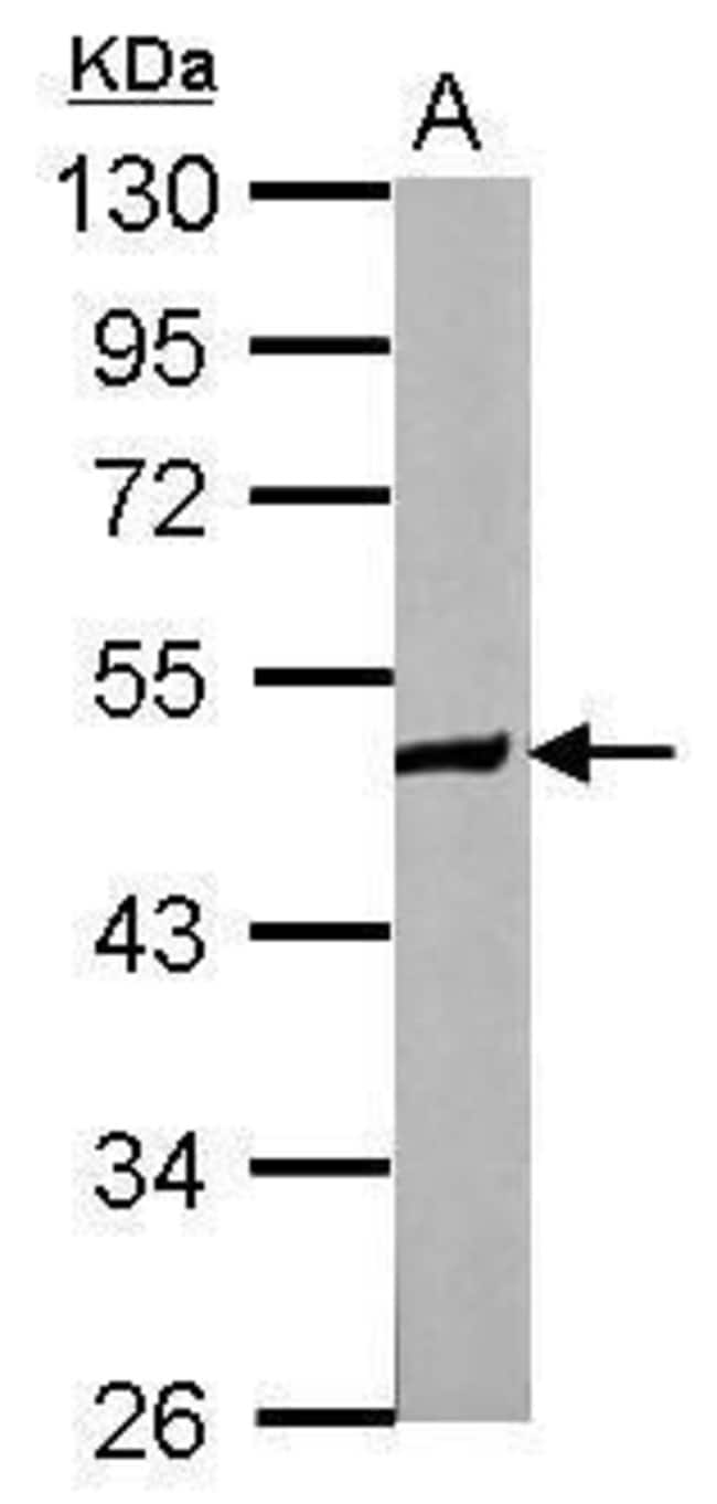 ANTI-ZNF322A