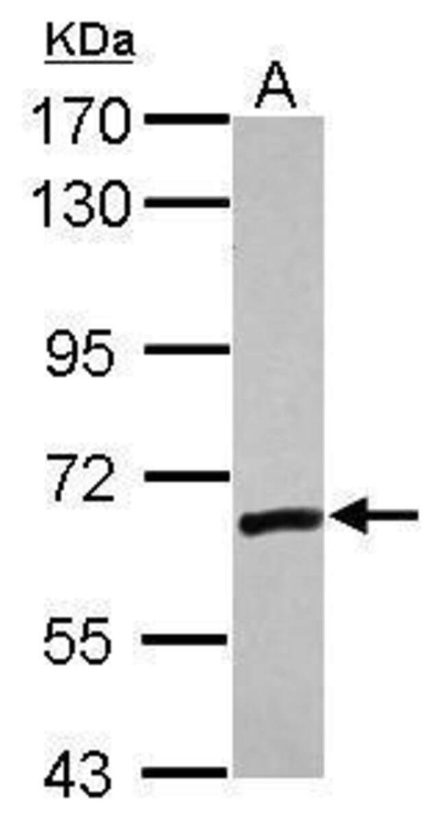 ANTI-ZNF419