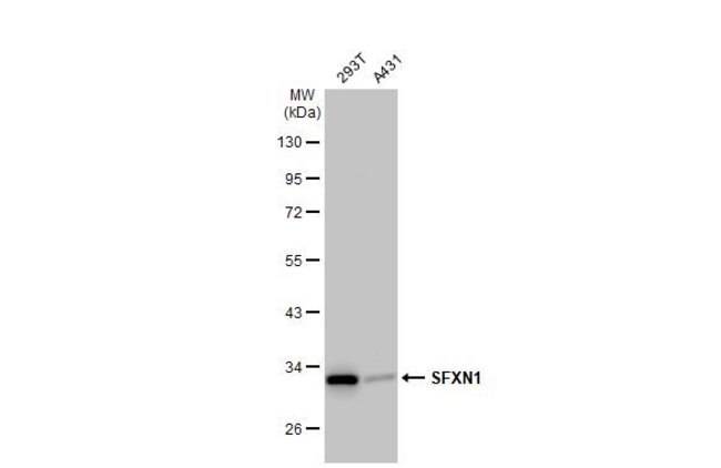 ANTI-SFXN1