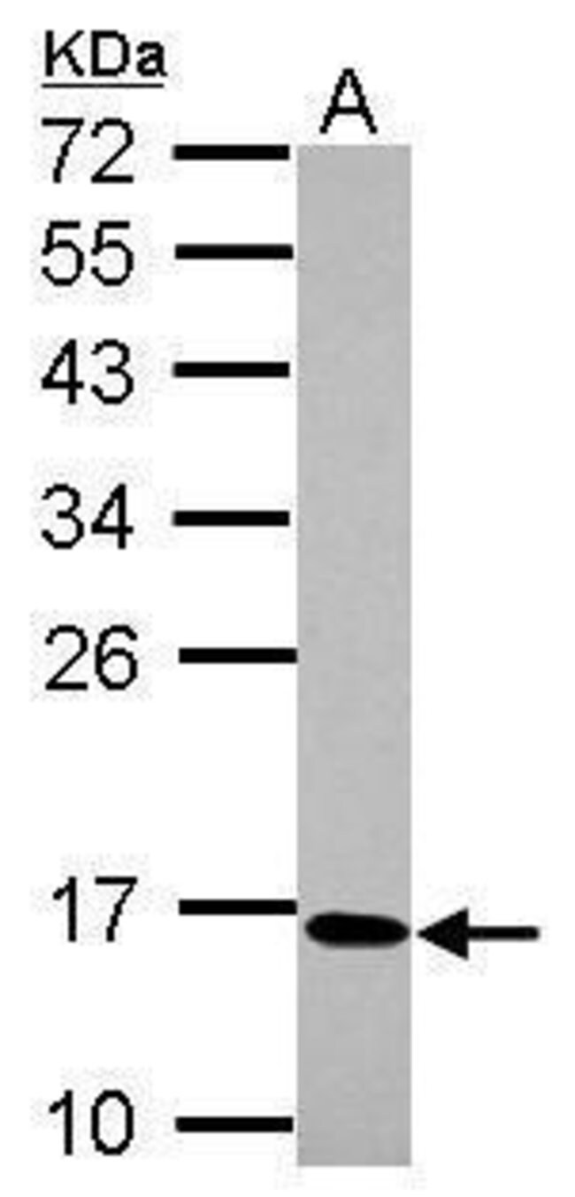 ANTI-C17ORF49