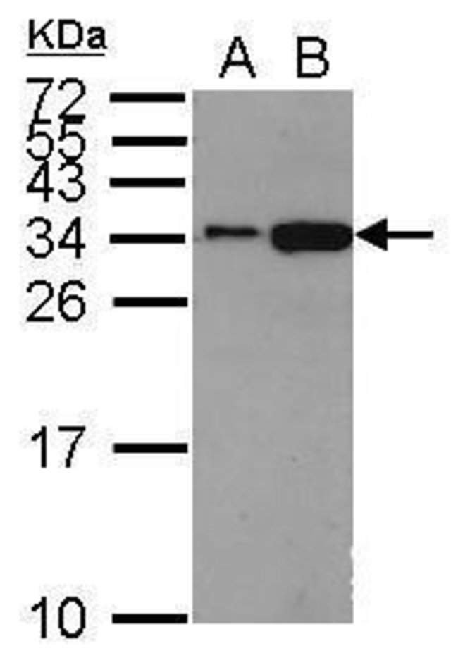 ANTI-HISTONE H1.2