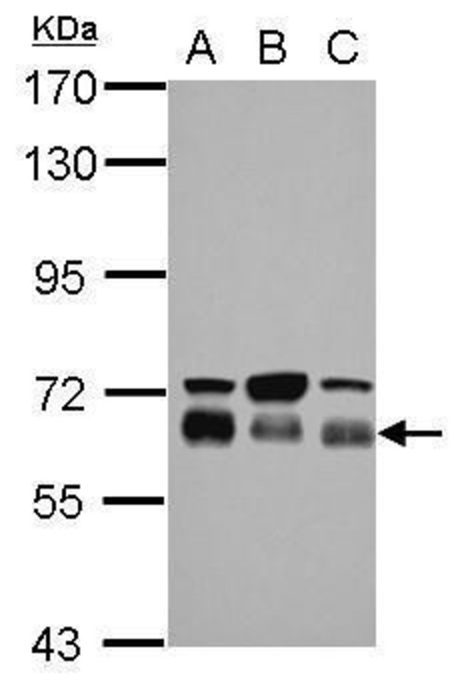 ANTI-TBC1D22A