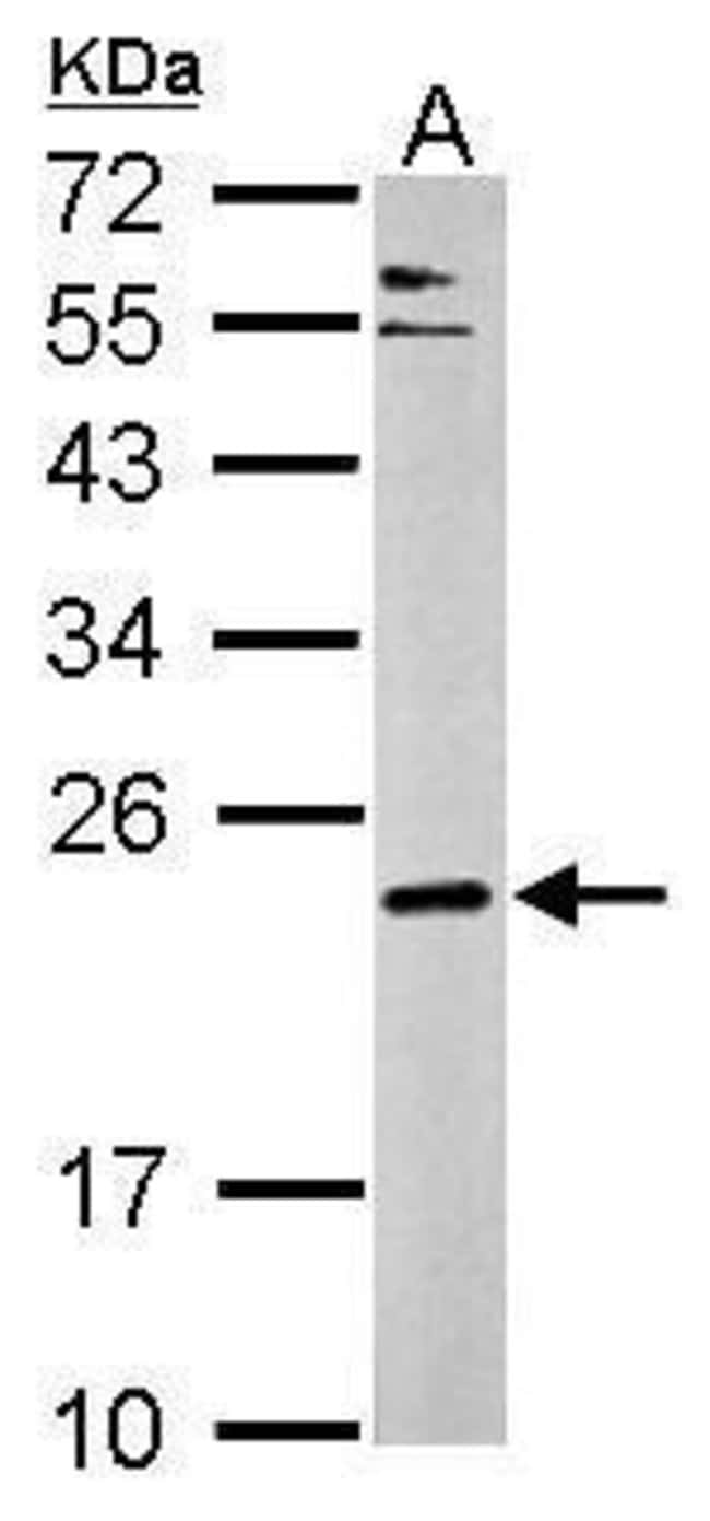 ANTI-COMPLEXIN 3