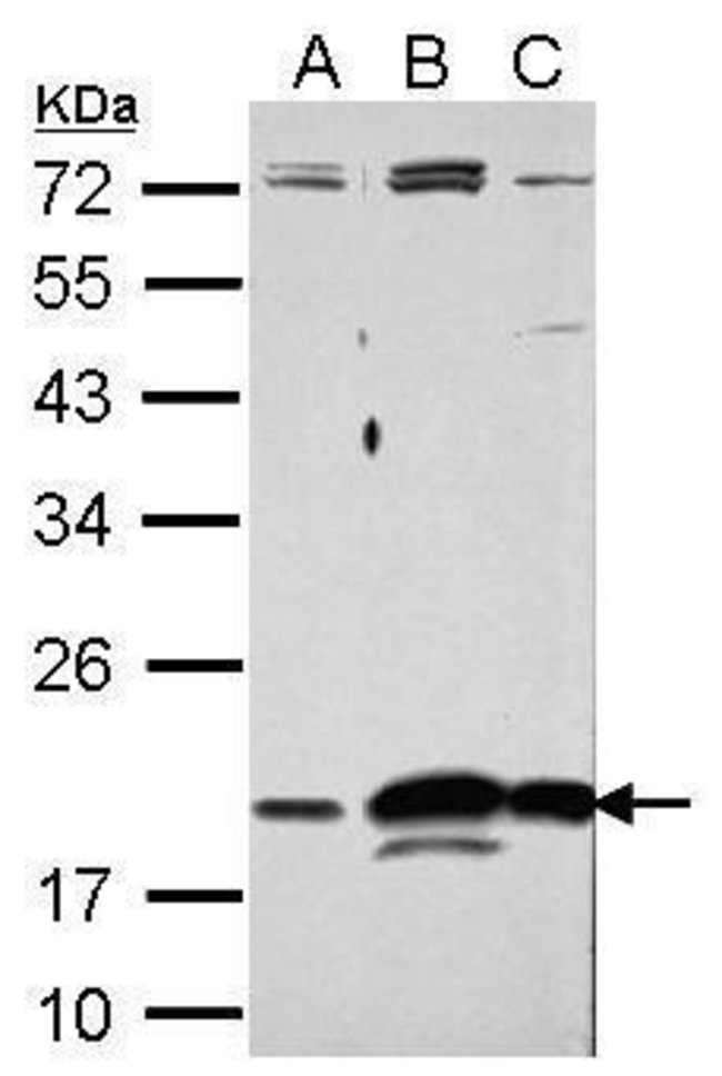 ANTI-RNASE11