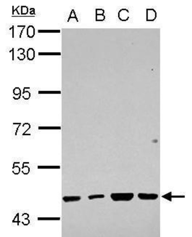 ANTI-RBMY1F